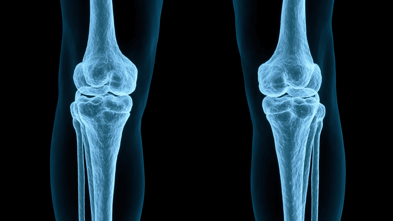 Radiografia che mostra una frattura nella zampa di un cane